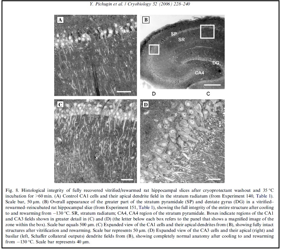 Hippocampal slice vitrified, stored at -130C and rewarmed (Pichugin et al. 2006)
