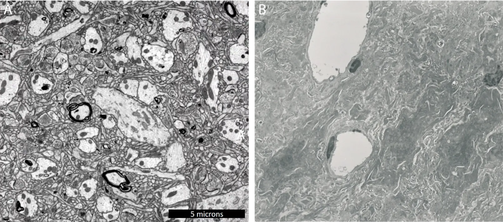 Electron micrographs comparing aldehyde-stabilized cryopreservation with conventional cryopreservation