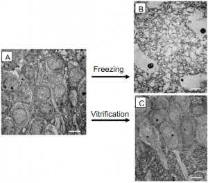 Figure1-freezing-vitrification