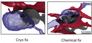 http://www.ncbi.nlm.nih.gov/pmc/articles/PMC4530226/